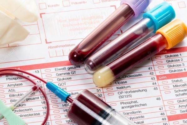 Các loại chỉ số xét nghiệm sinh hóa máu