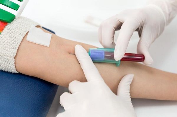 Tìm hiểu về khái niệm xét nghiệm sinh hóa máu là gì