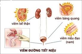 Viêm đường tiết niệu căn bệnh không nên xem thường