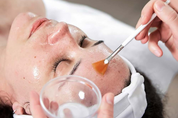 Đối tượng cần thận trọng khi peel da