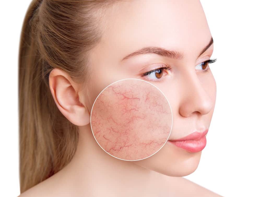 Những trường hợp không nên thực hiện peel da